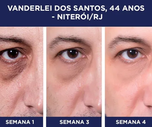 Crema Reafirmante Para El Contorno De Los Ojos