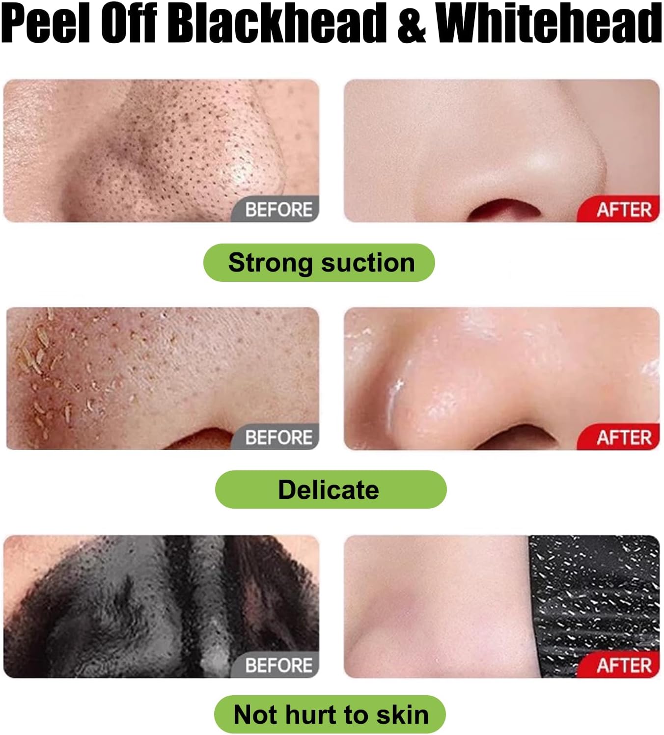 Mascarilla De Carbón Para Blanquear Los Poros