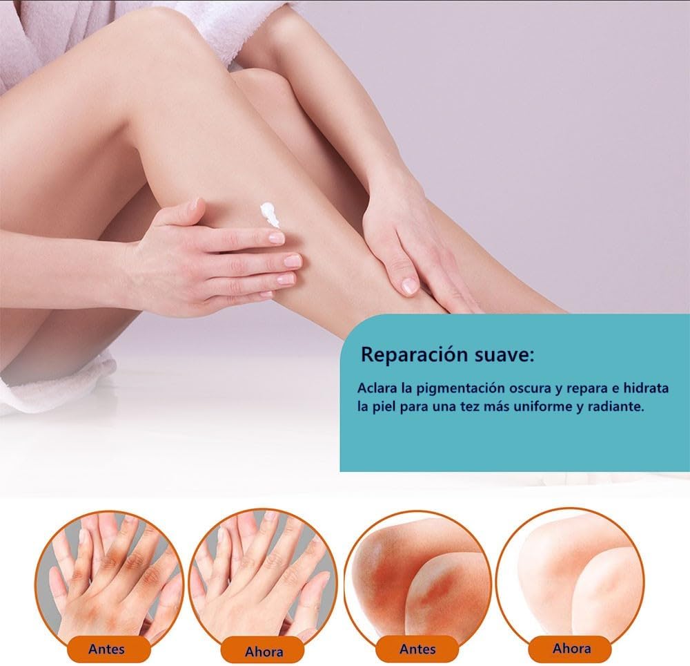 CREMA ACLARANTE BLANQUEADORA - CREMA CORRECTORA DE MANCHAS OSCURAS
