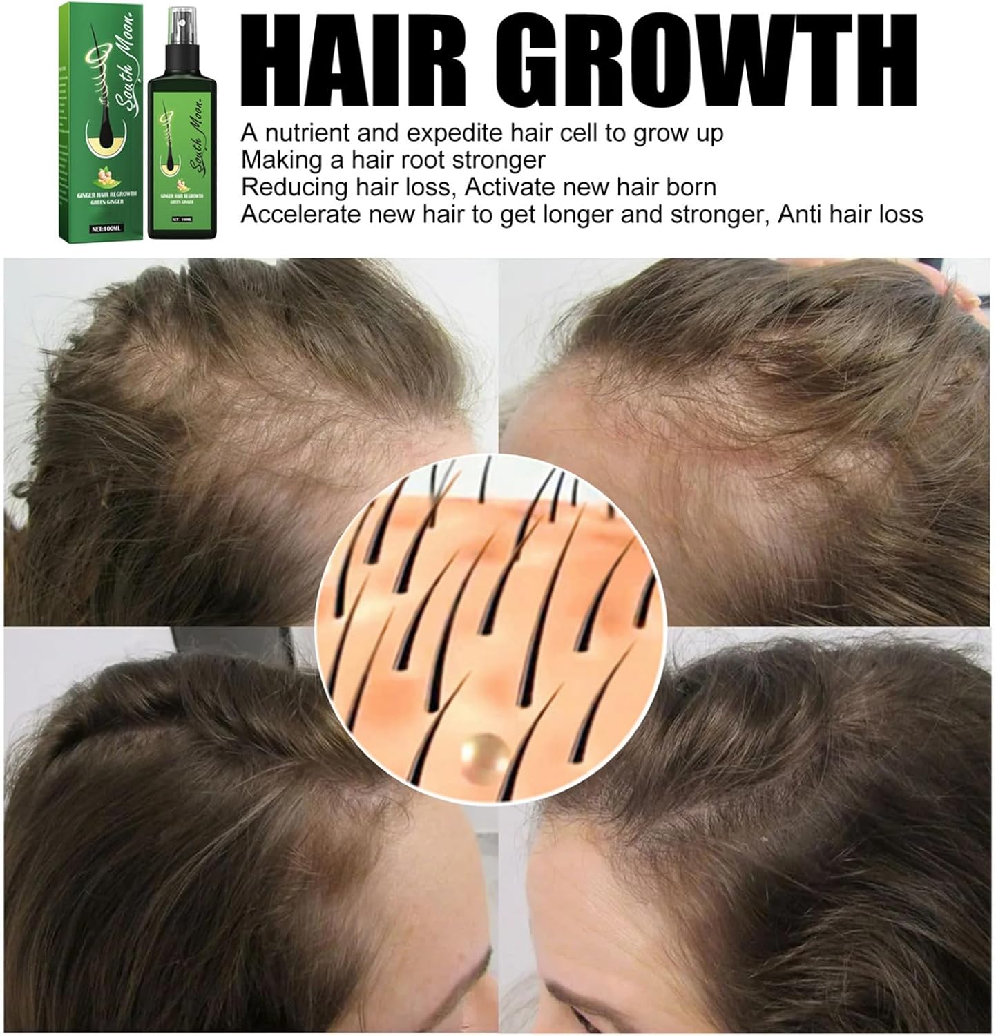 SPRAY DE CRECIMIENTO DEL CABELLO