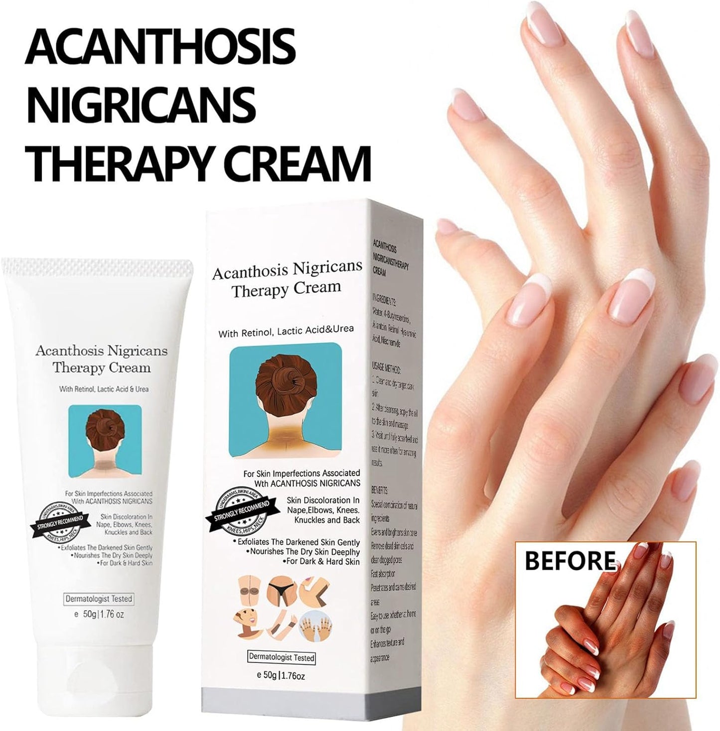 CREMA ACLARANTE BLANQUEADORA - CREMA CORRECTORA DE MANCHAS OSCURAS