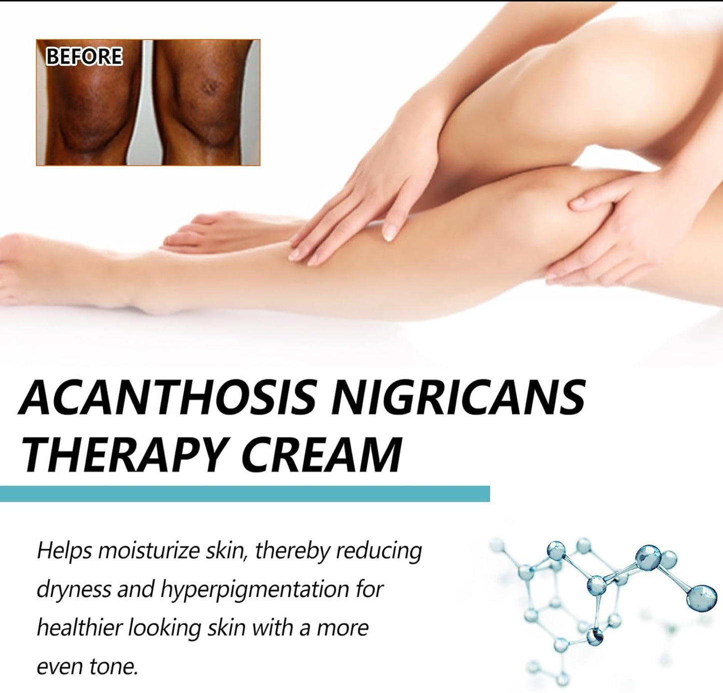 CREMA ACLARANTE BLANQUEADORA - CREMA CORRECTORA DE MANCHAS OSCURAS