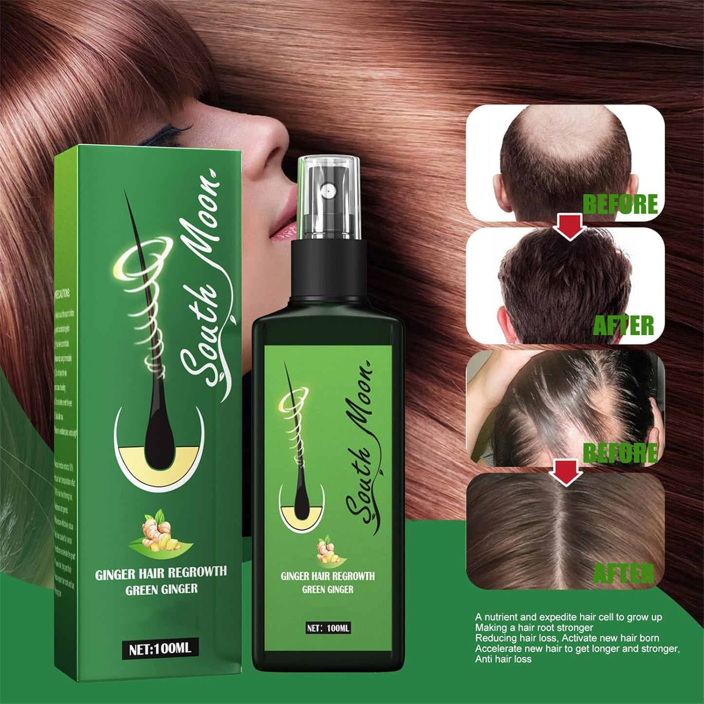 SPRAY DE CRECIMIENTO DEL CABELLO