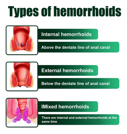 Crema Para Hemorroides