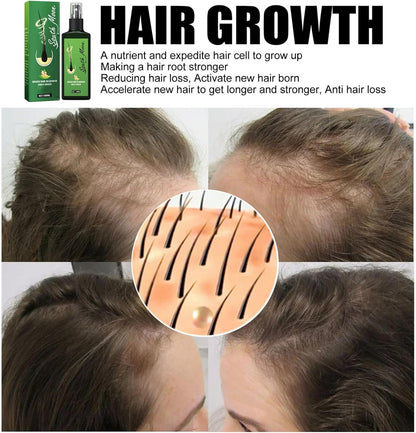 SPRAY DE CRECIMIENTO DEL CABELLO