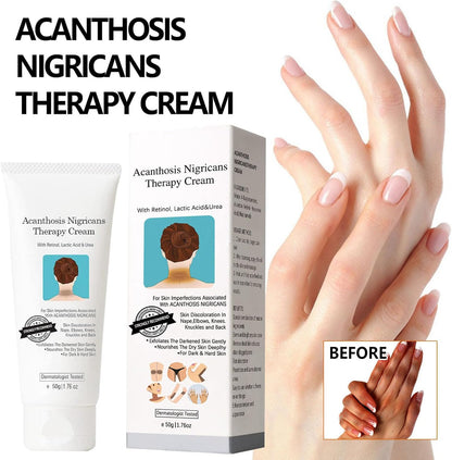 CREMA ACLARANTE BLANQUEADORA - CREMA CORRECTORA DE MANCHAS OSCURAS